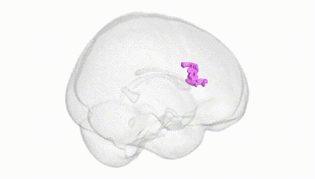 Full Brain White