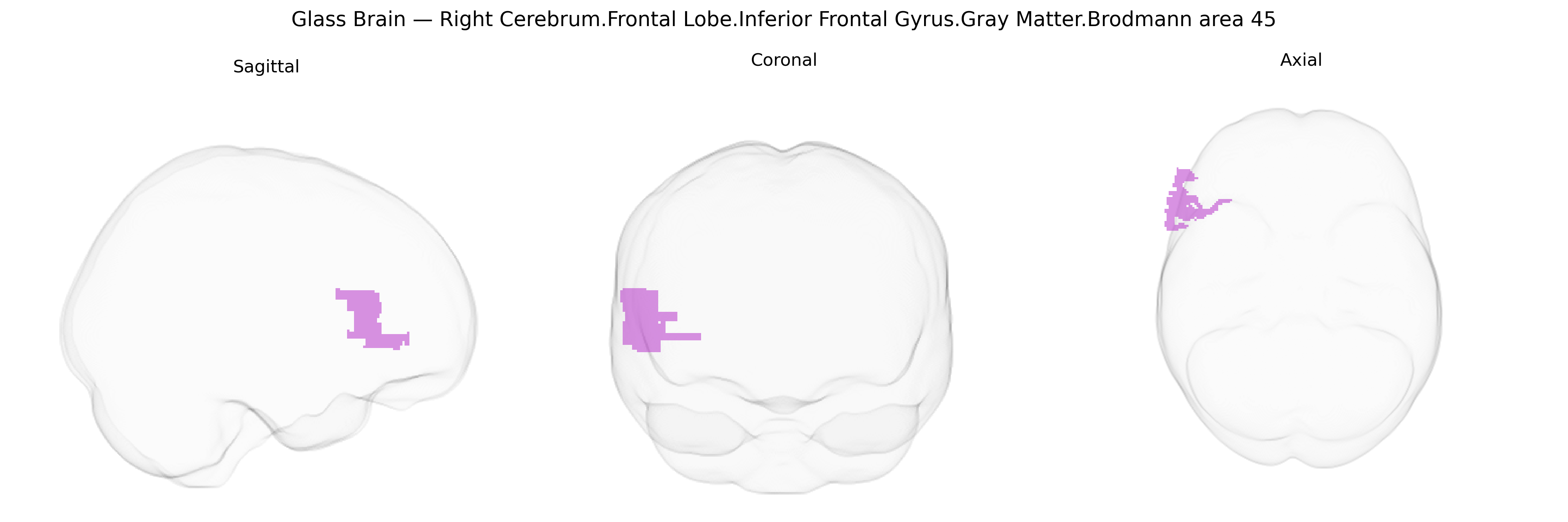 Triplanar Ghost Brain