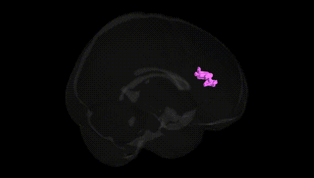 Full Brain Black