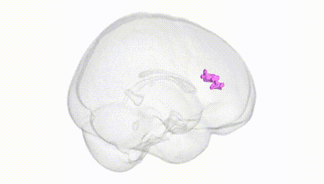 Full Brain White