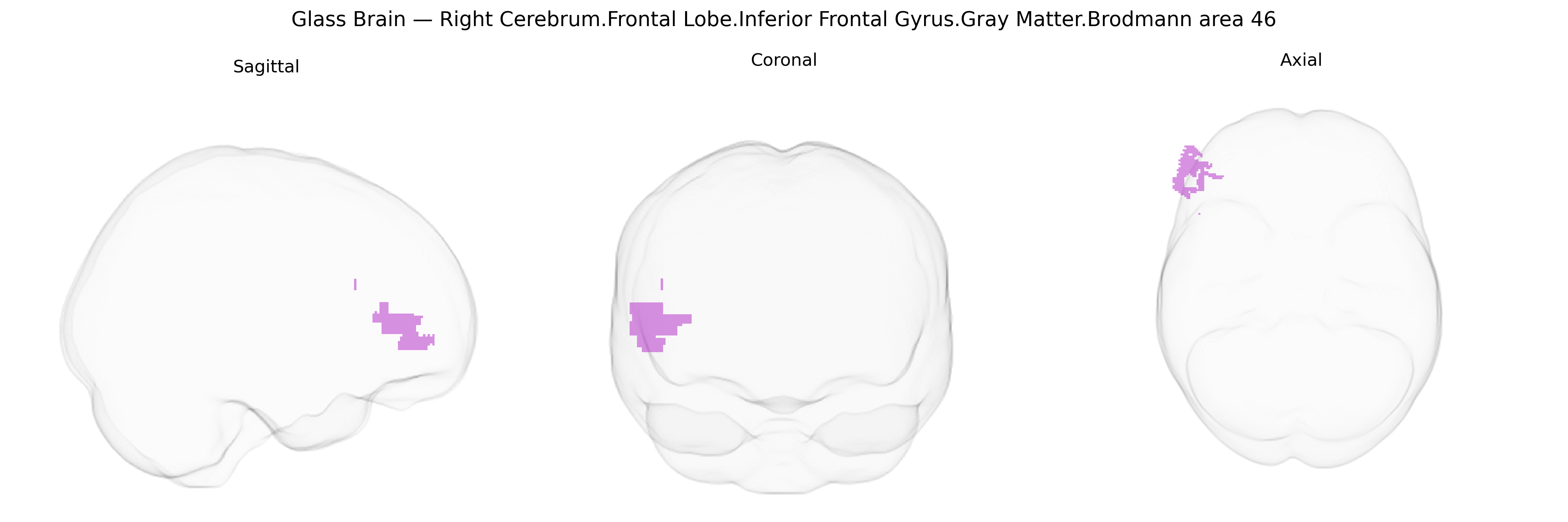 Triplanar Ghost Brain