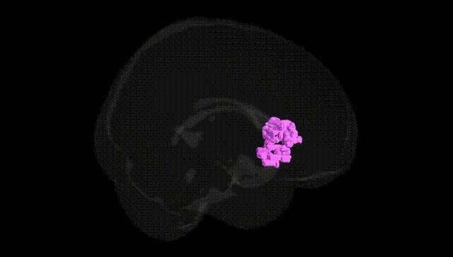 Full Brain Black