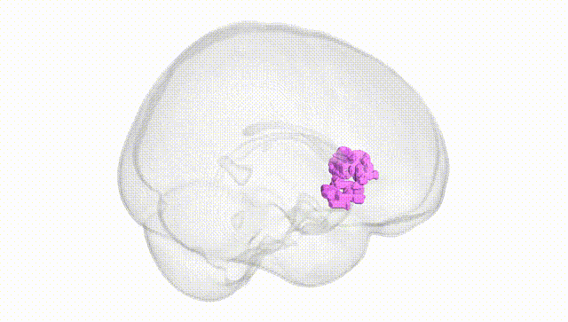 Full Brain White