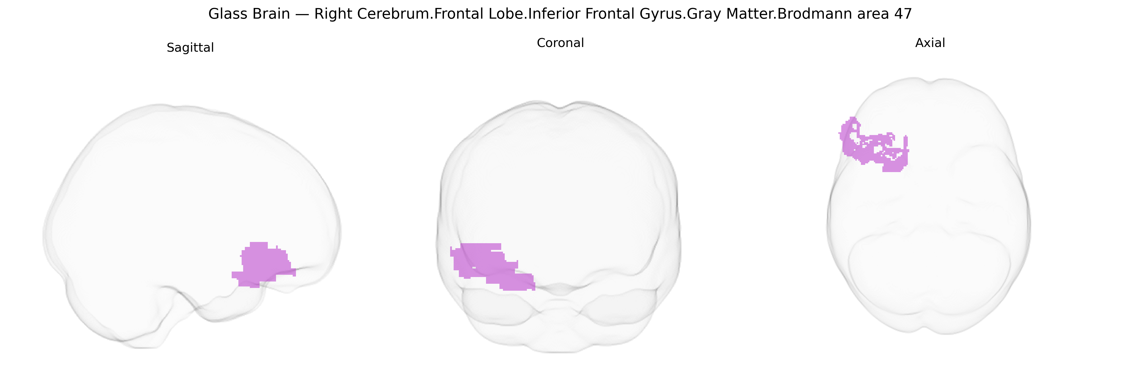 Triplanar Ghost Brain