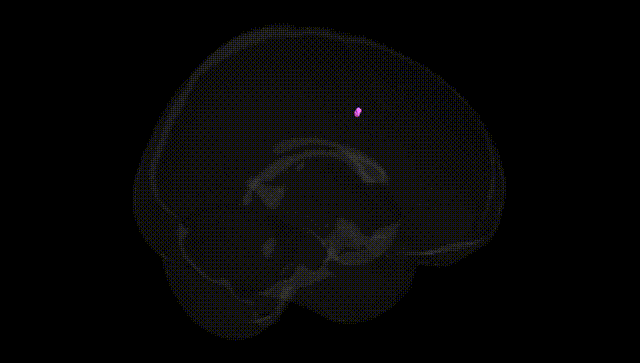 Full Brain Black