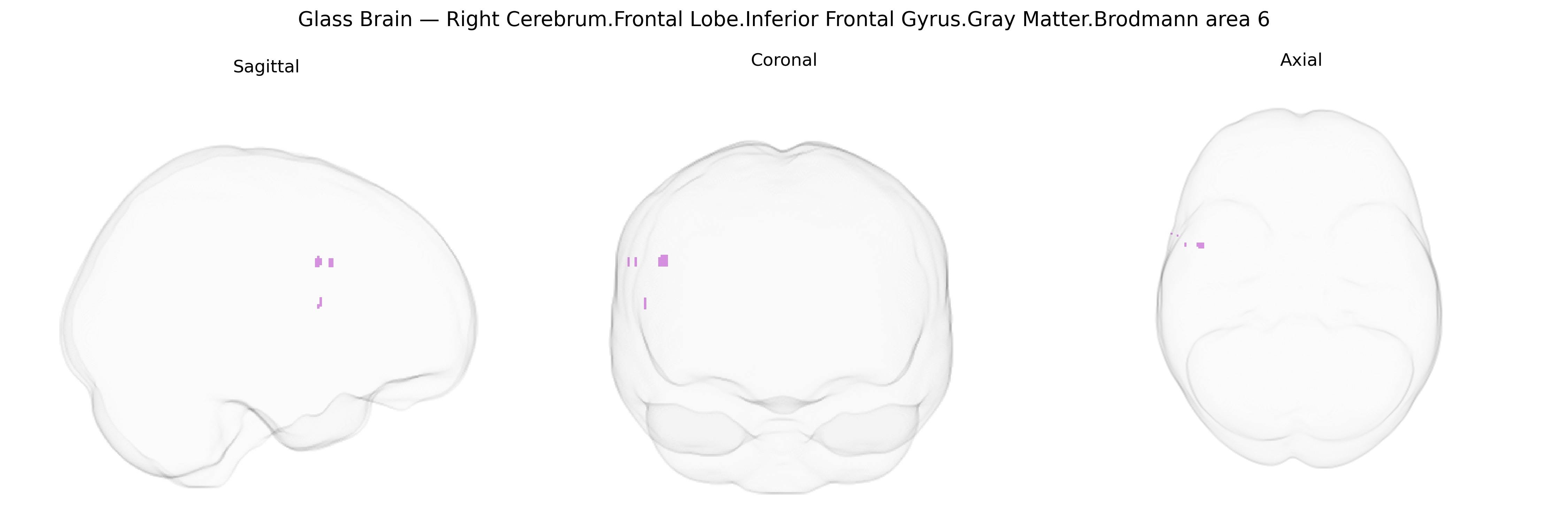 Triplanar Ghost Brain