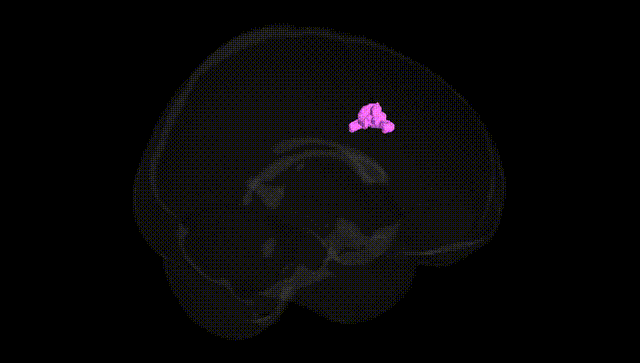 Full Brain Black