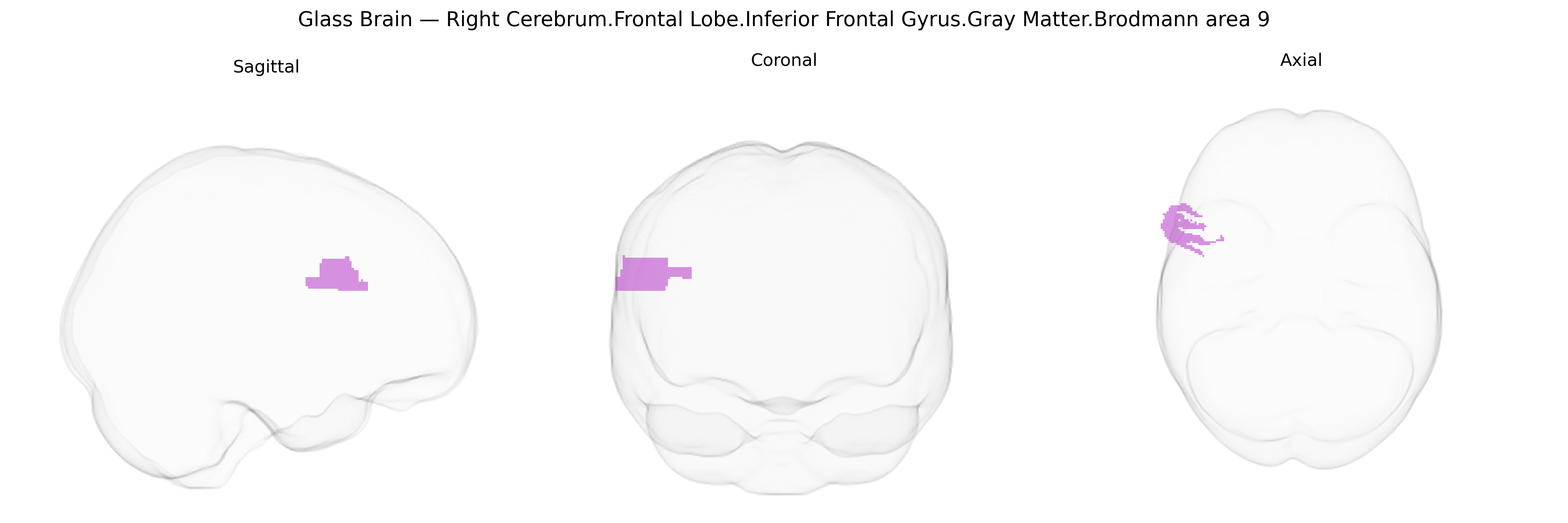 Triplanar Ghost Brain
