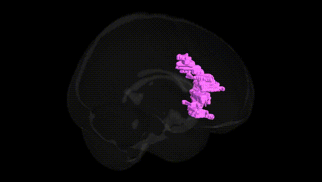 Full Brain Black