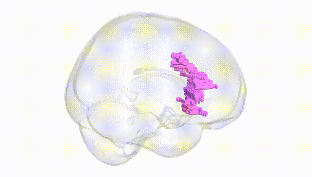 Full Brain White