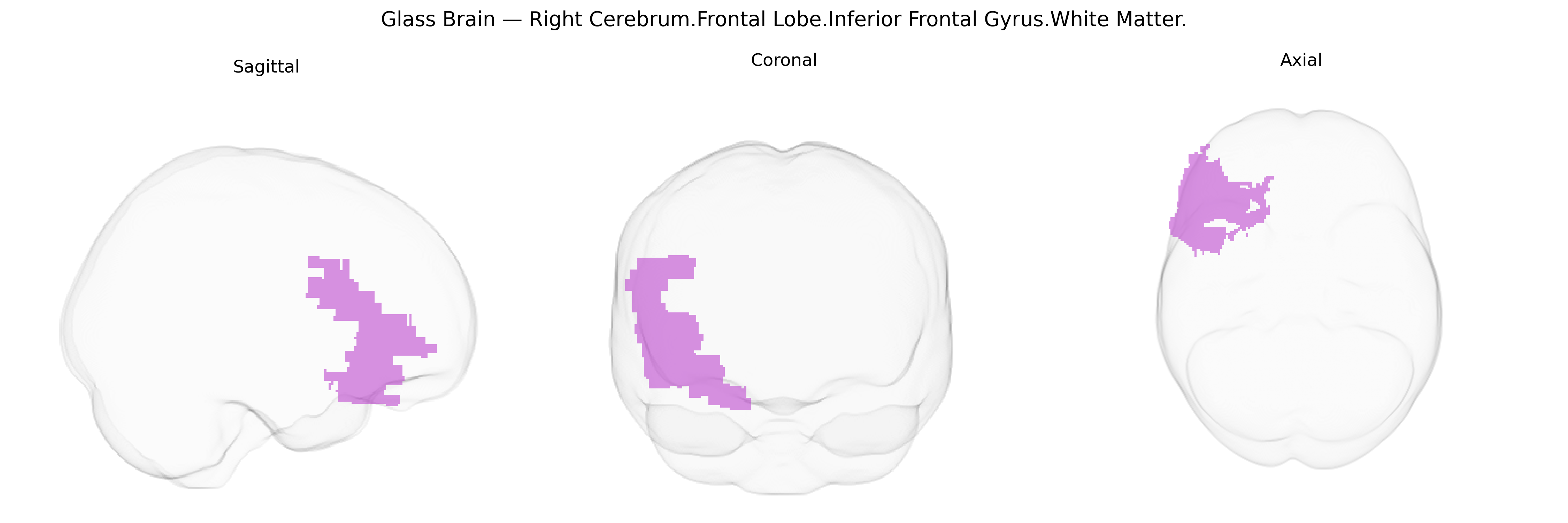Triplanar Ghost Brain