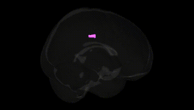 Full Brain Black