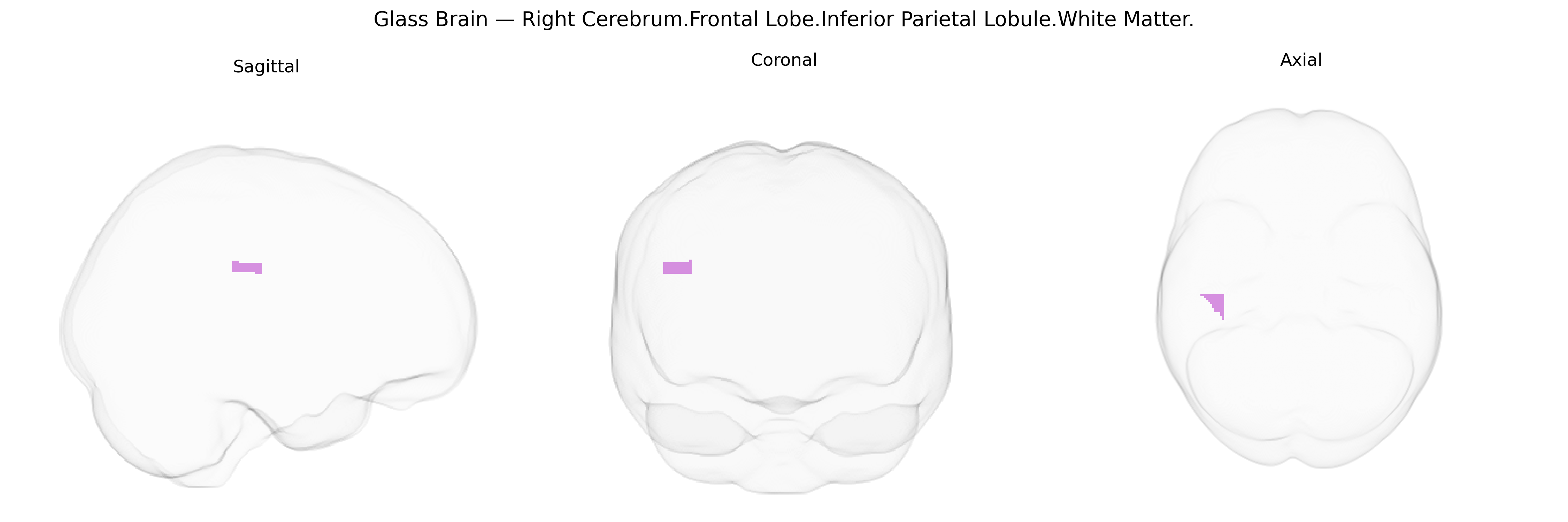 Triplanar Ghost Brain