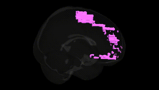 Full Brain Black