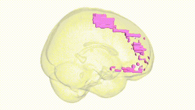 Full Brain White