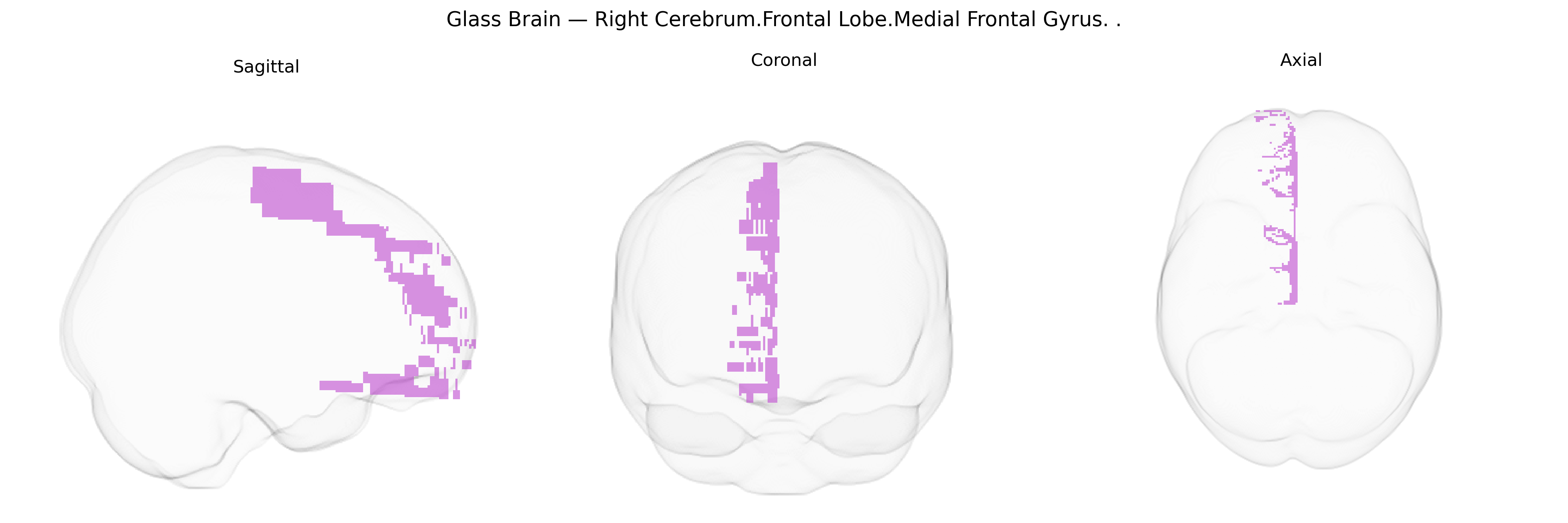 Triplanar Ghost Brain