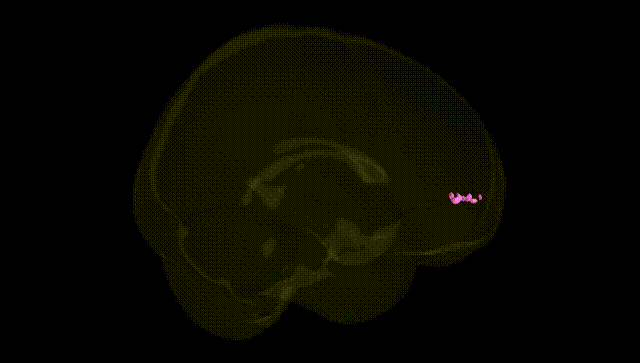 Full Brain Black