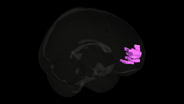 Full Brain Black