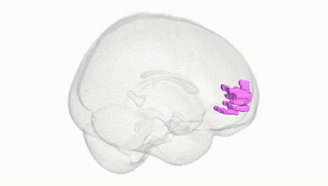 Full Brain White