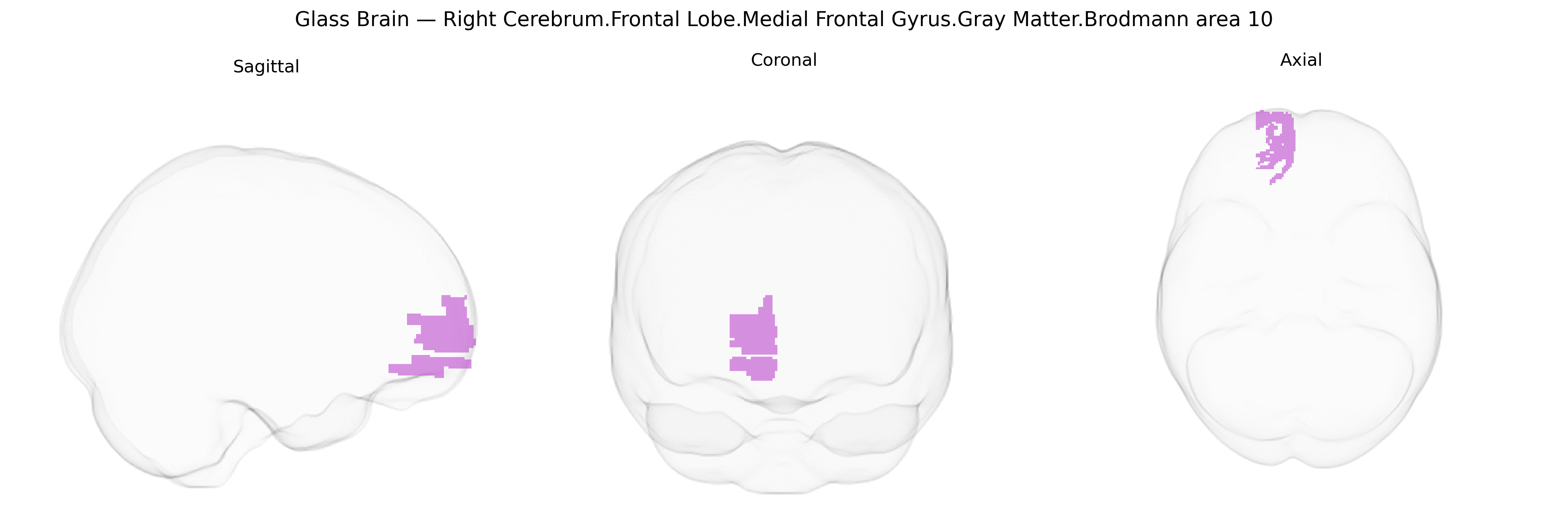Triplanar Ghost Brain