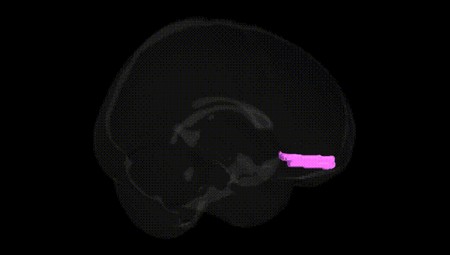 Full Brain Black