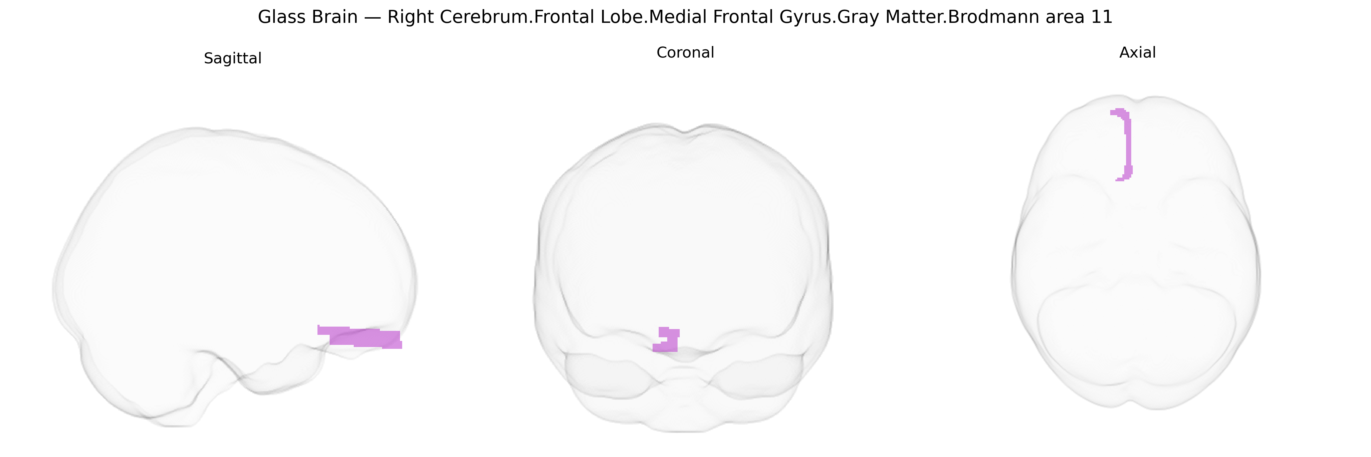 Triplanar Ghost Brain