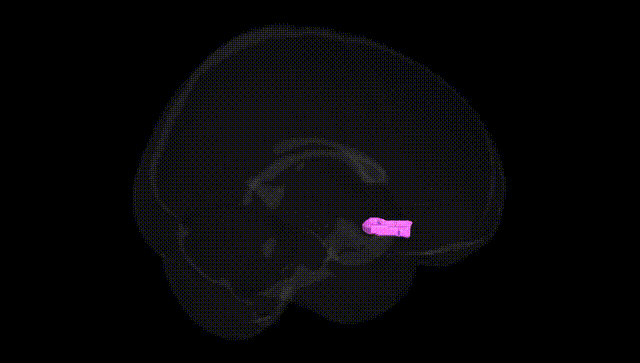 Full Brain Black