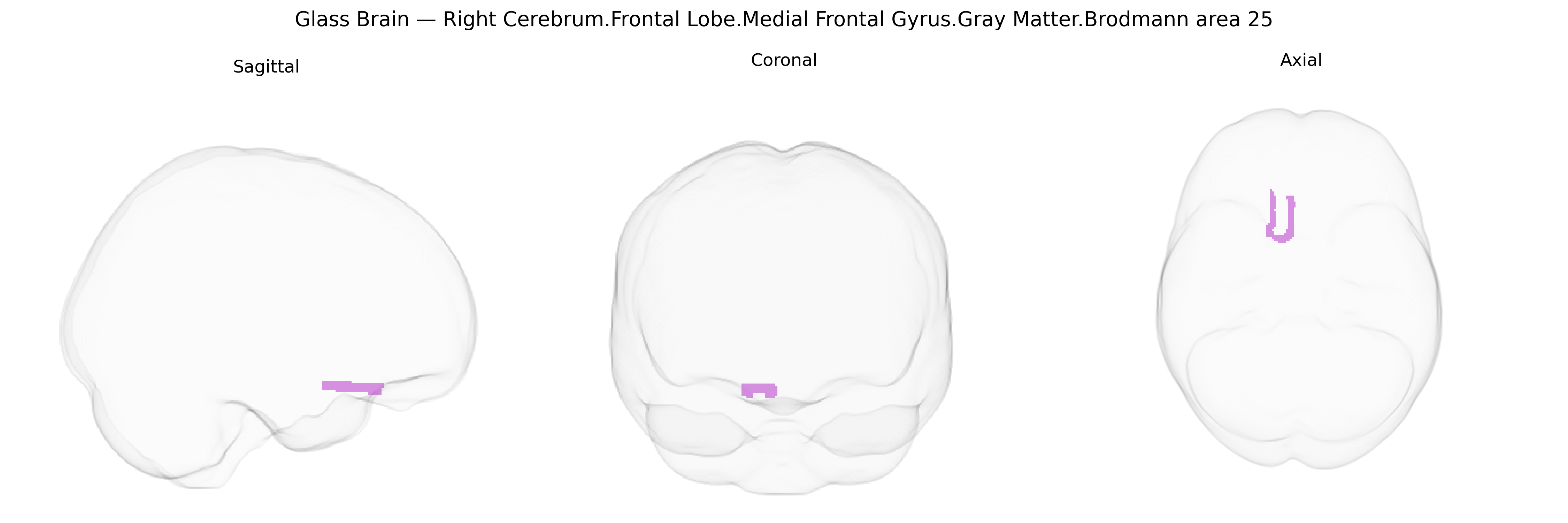 Triplanar Ghost Brain