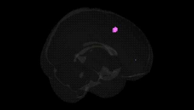 Full Brain Black