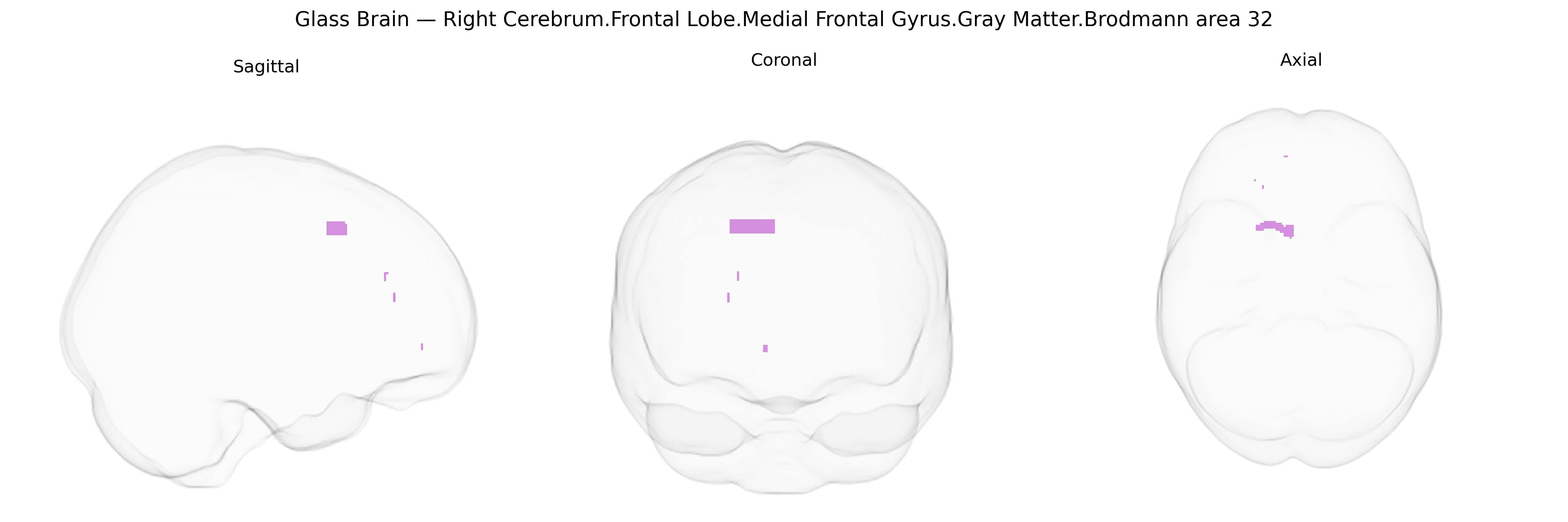 Triplanar Ghost Brain