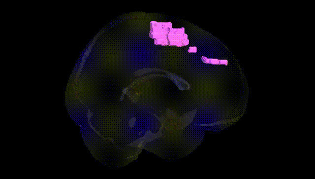 Full Brain Black