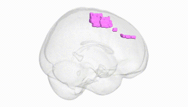 Full Brain White