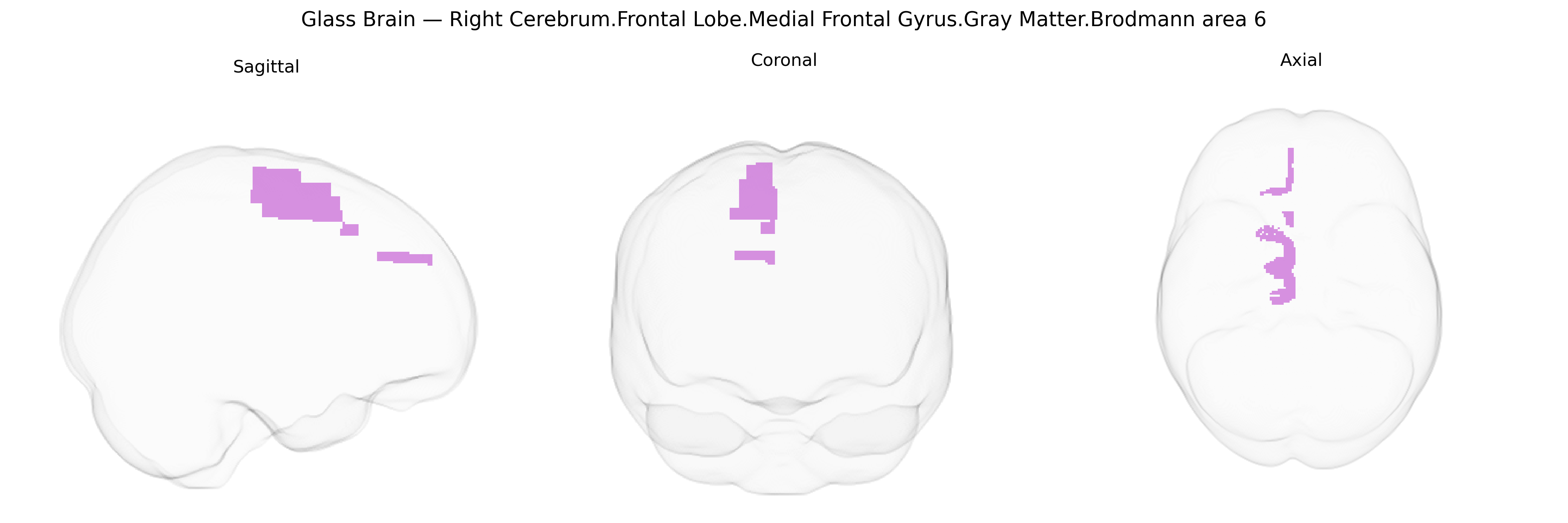 Triplanar Ghost Brain