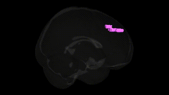Full Brain Black