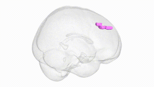 Full Brain White