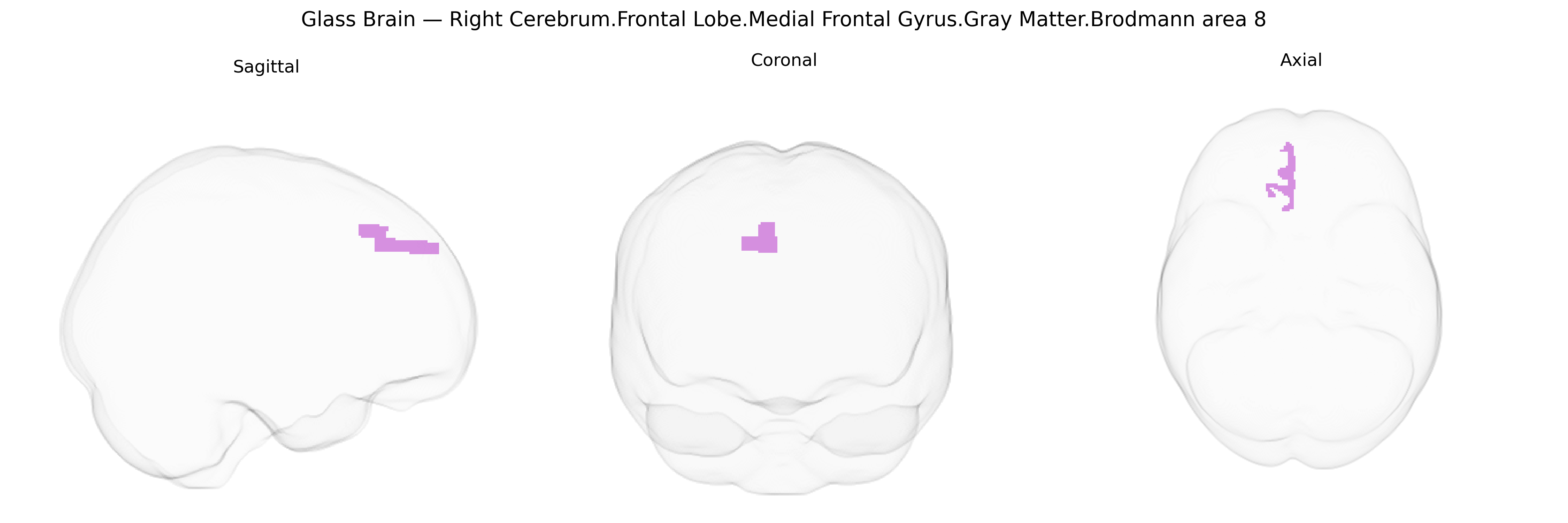 Triplanar Ghost Brain