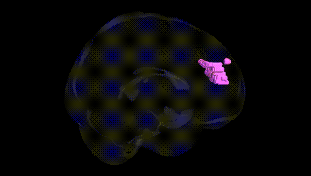 Full Brain Black