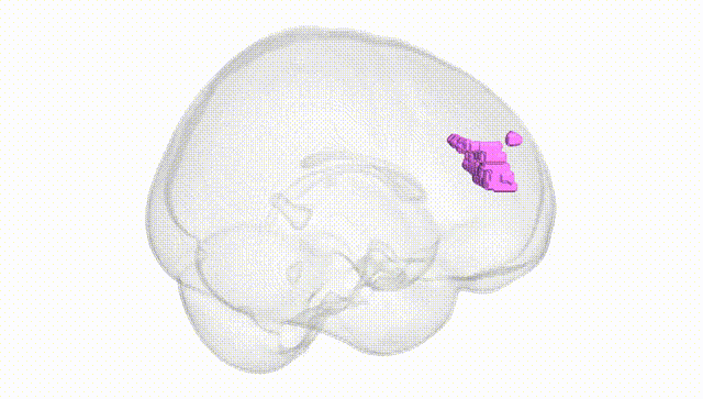 Full Brain White