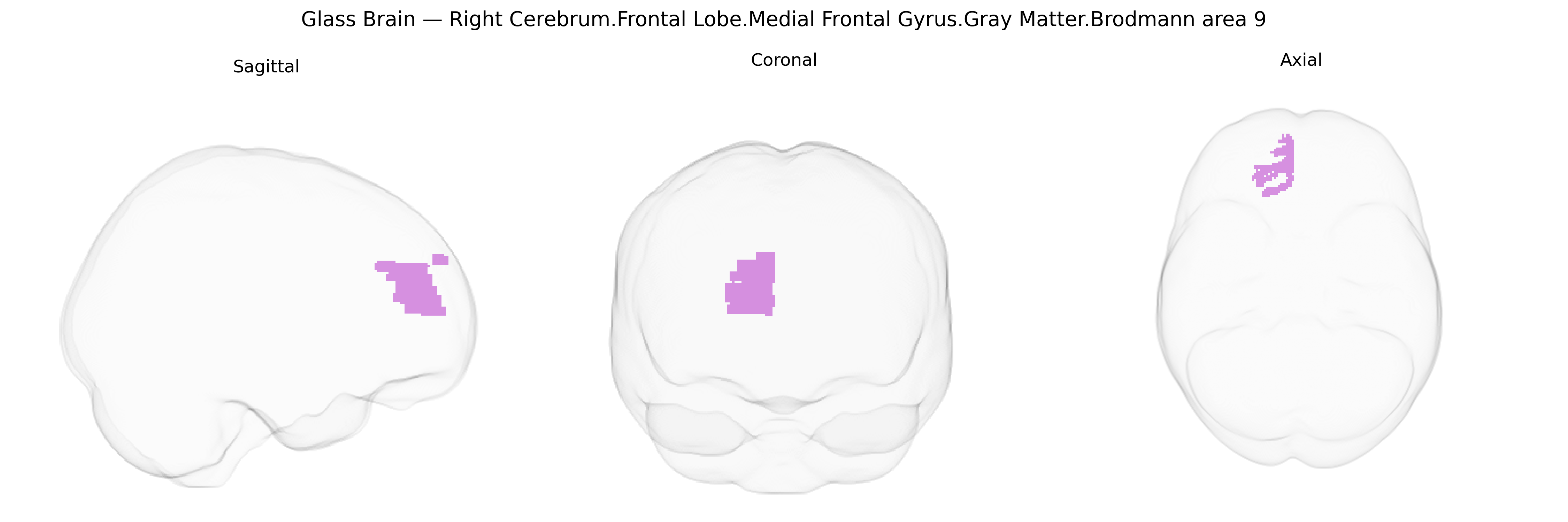 Triplanar Ghost Brain