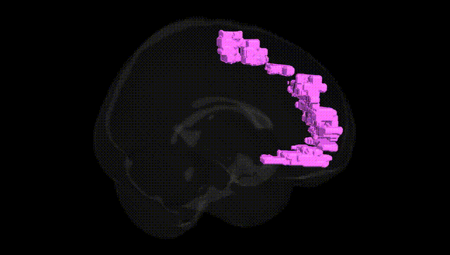 Full Brain Black