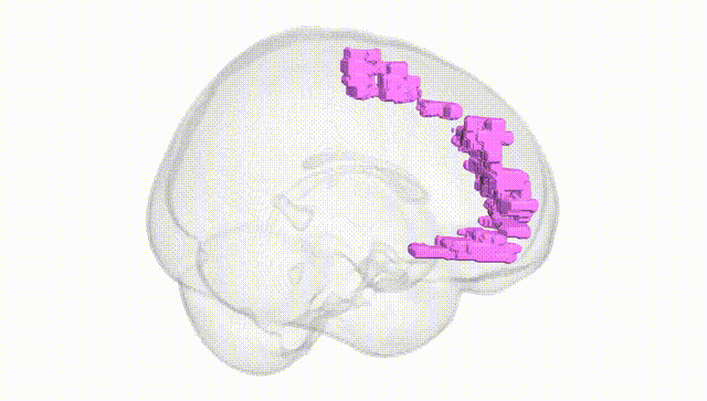 Full Brain White