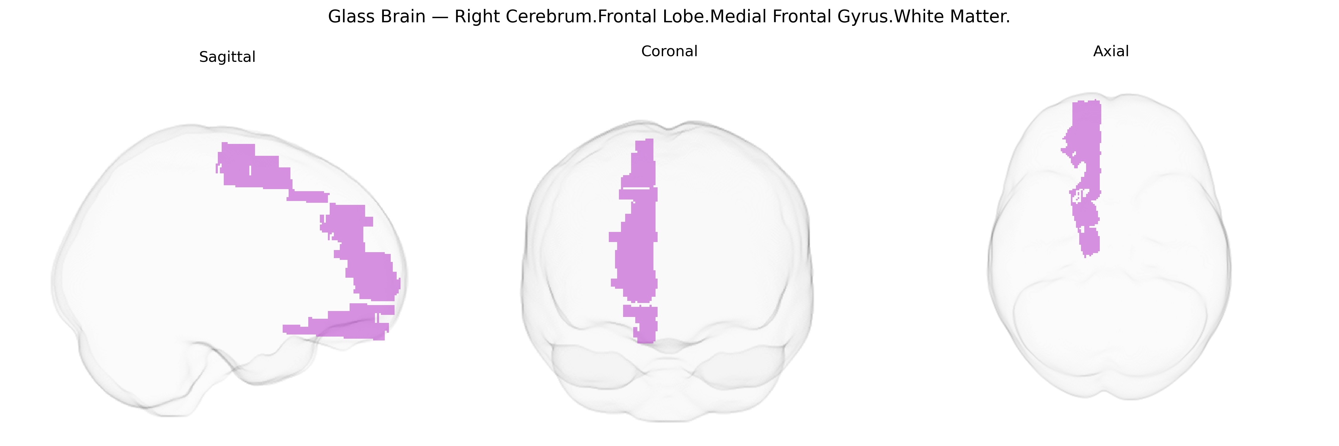 Triplanar Ghost Brain