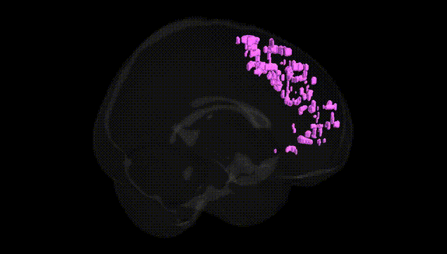 Full Brain Black
