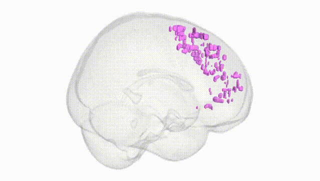 Full Brain White