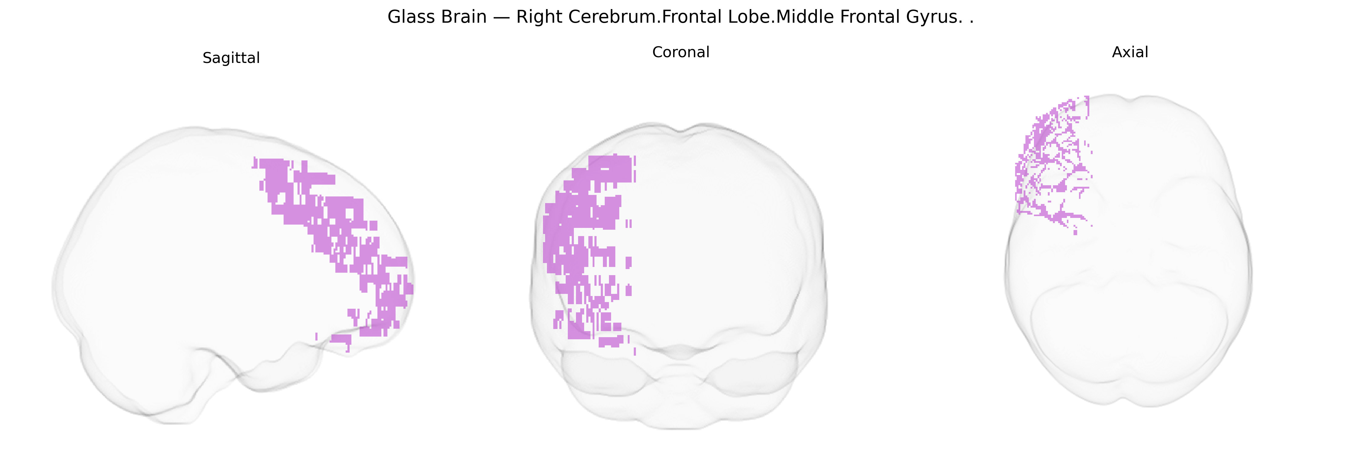 Triplanar Ghost Brain