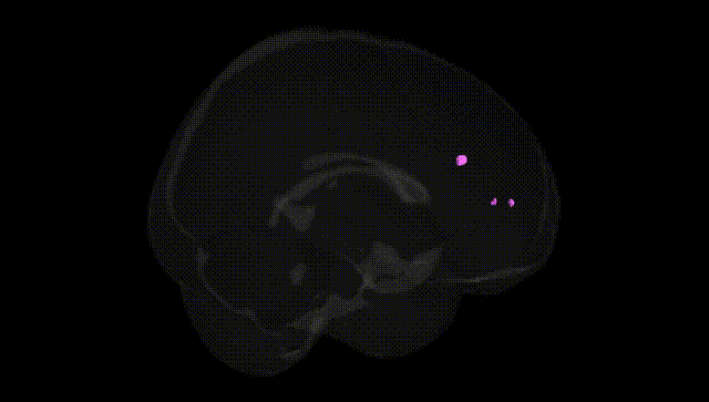 Full Brain Black
