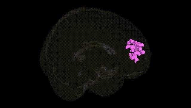 Full Brain Black