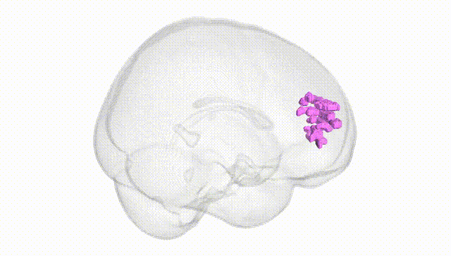 Full Brain White