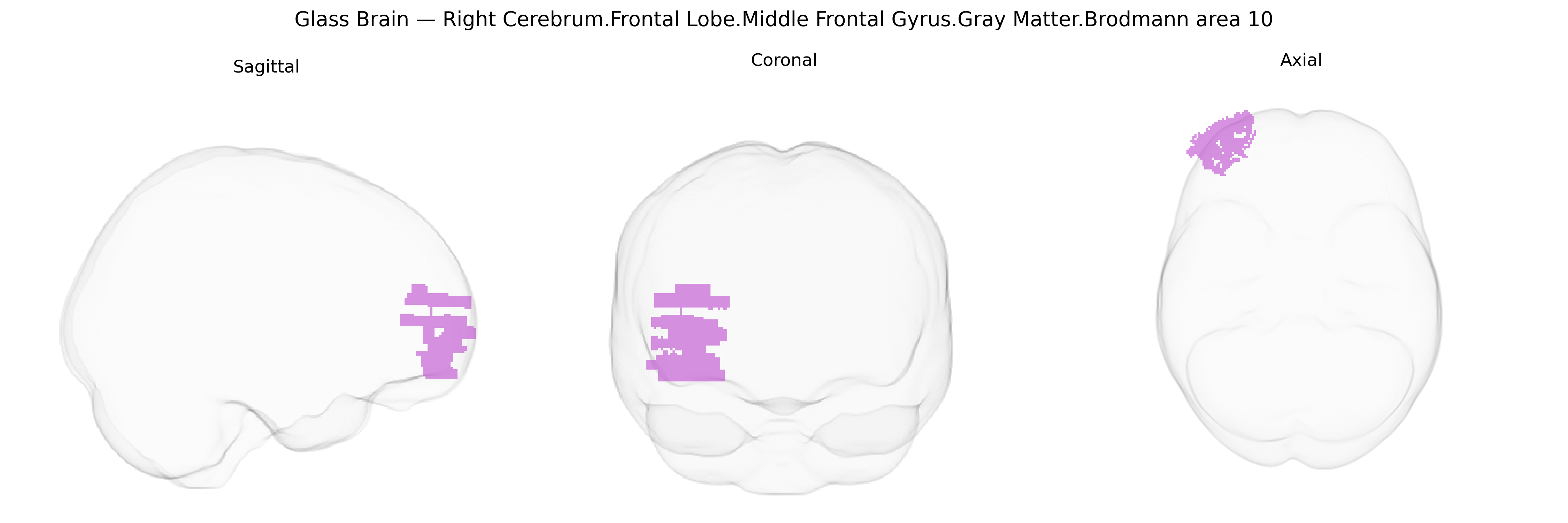 Triplanar Ghost Brain