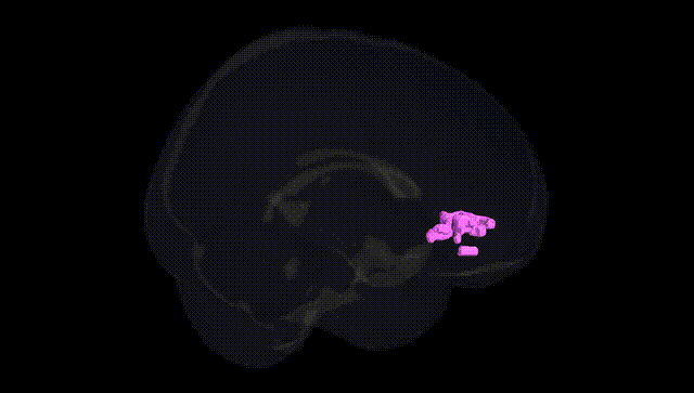 Full Brain Black